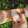 New Insect Bite Relief Device Pest Control