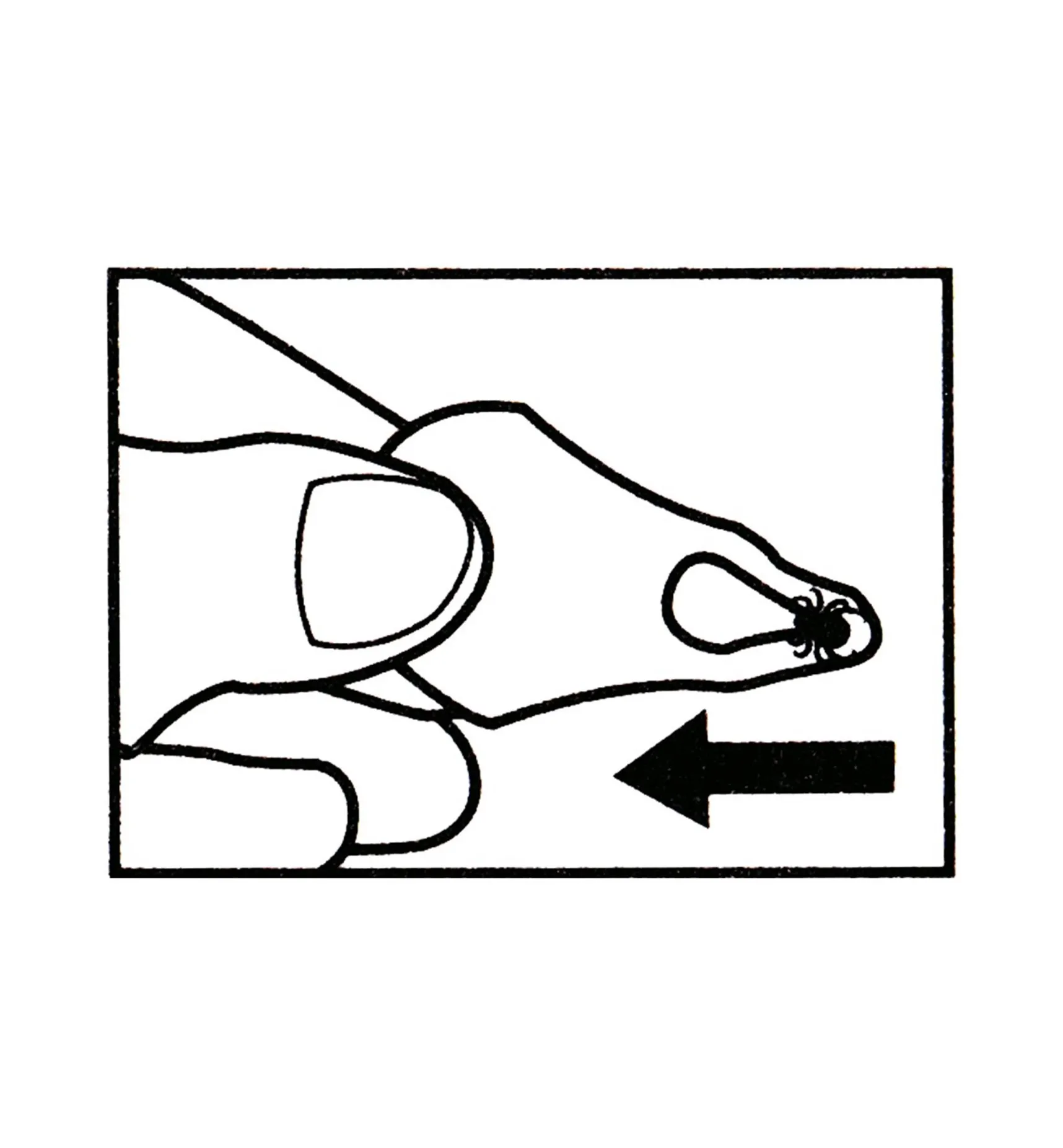 Online Set Of 3 Tick Key Tick Removers Pest Control