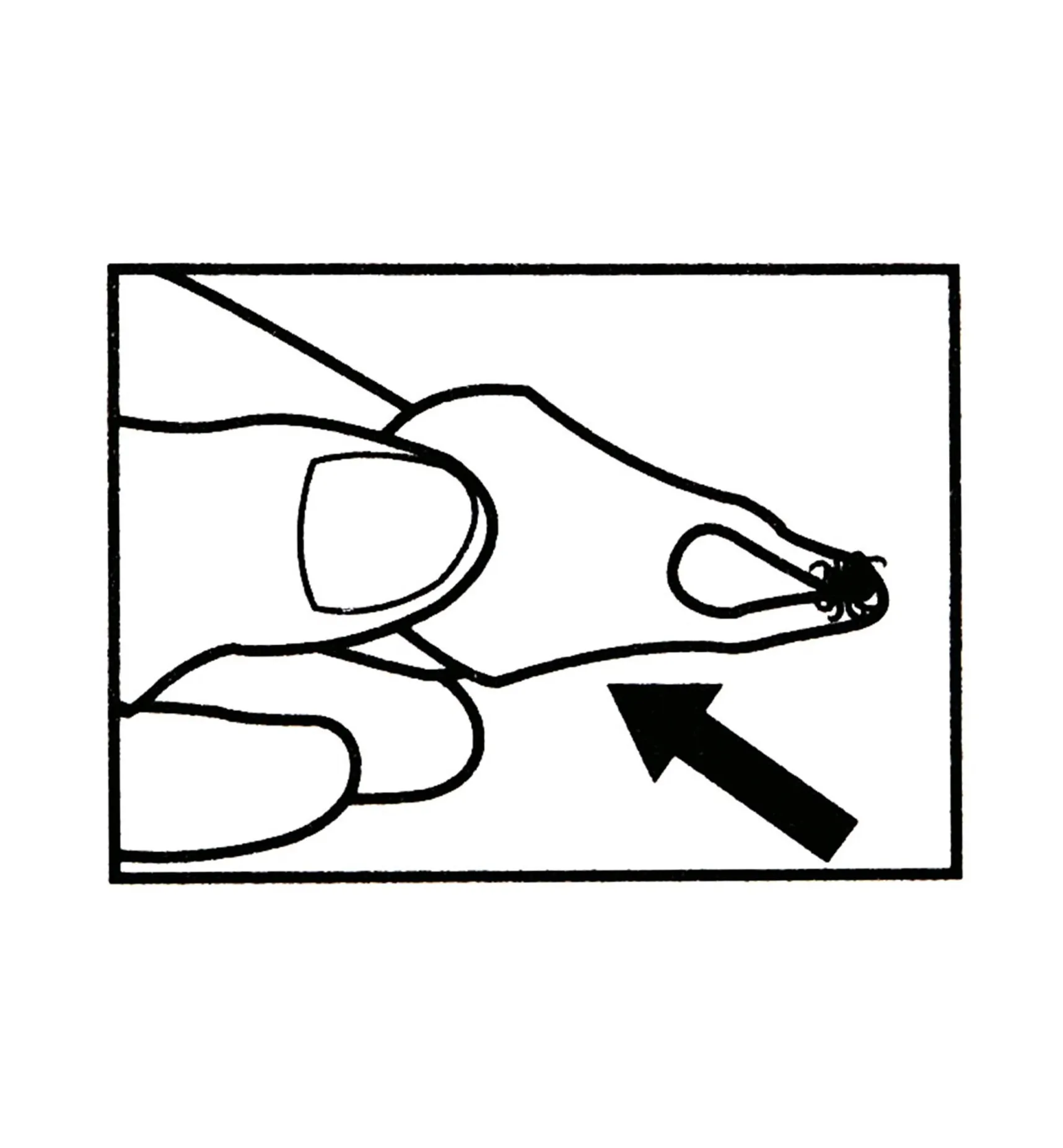 Online Set Of 3 Tick Key Tick Removers Pest Control