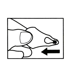 Best Tick Key Tick Remover Pest Control